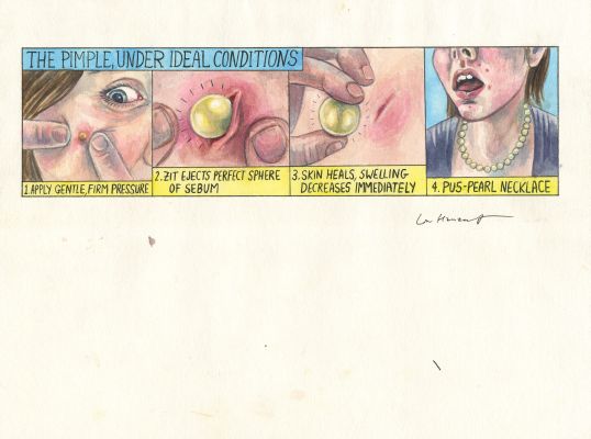 Lisa Hanawalt | The Pimple, Under Ideal Conditions - Aquarelle sur papier | Huberty Breyne Gallery